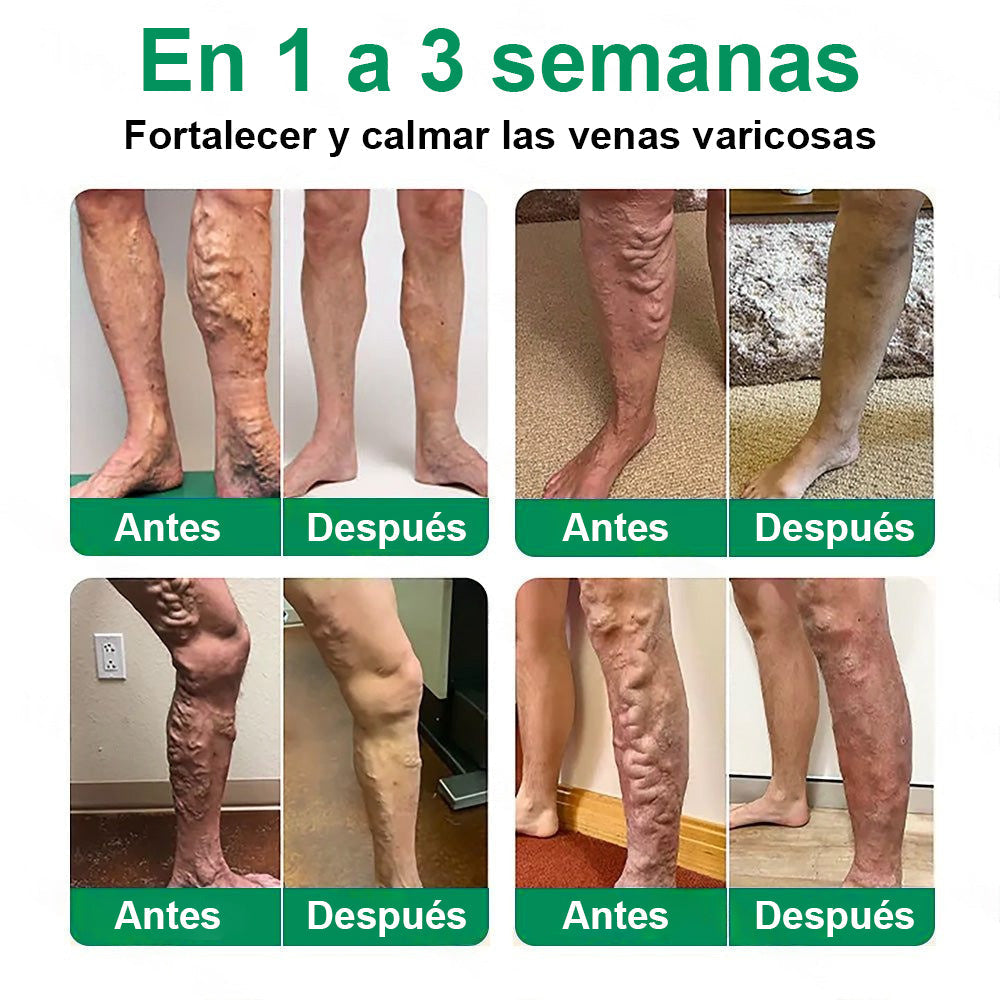 🇵🇦👨‍⚕️✅ Healrize® VeinTarget parche de microagujas ⚡ Alivio inmediato, resultados duraderos